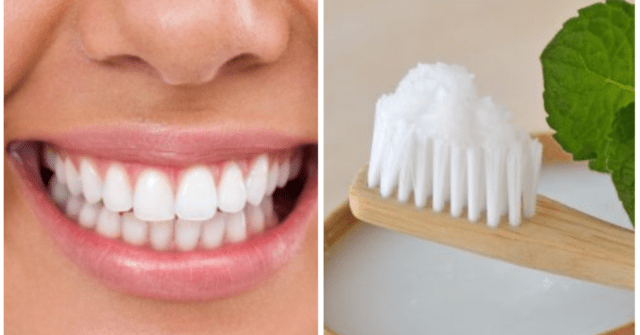 Cúrcuma, aceite de coco, xilitol para los dientes amarillos