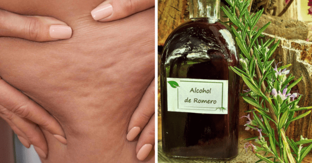 Alcohol de Romero para dolores articulares