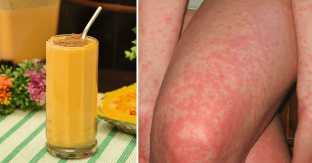 Piña, naranja y calabaza para las alergias