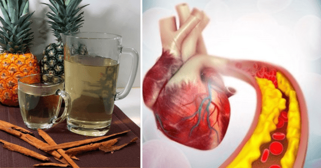 Piña con canela para niveles de colesterol y triglicéridos