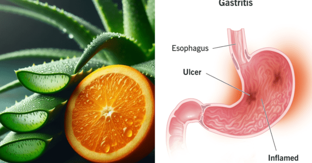 Aloe vera y naranja para la gastritis