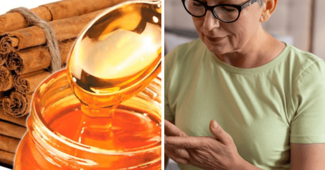 Miel con canela para la diabetes y