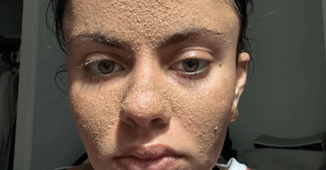El resultado dejó a todos sorprendidos: TikToker de 22 años se vuelve viral por dejar de lavarse la cara