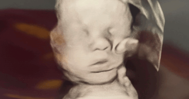 Madre asegura que la “mano de Dios” tocó a su bebé durante una ecografía