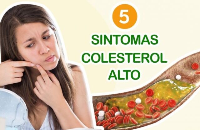 Síntomas de colesterol alto: mira cómo identificarlo y actuar