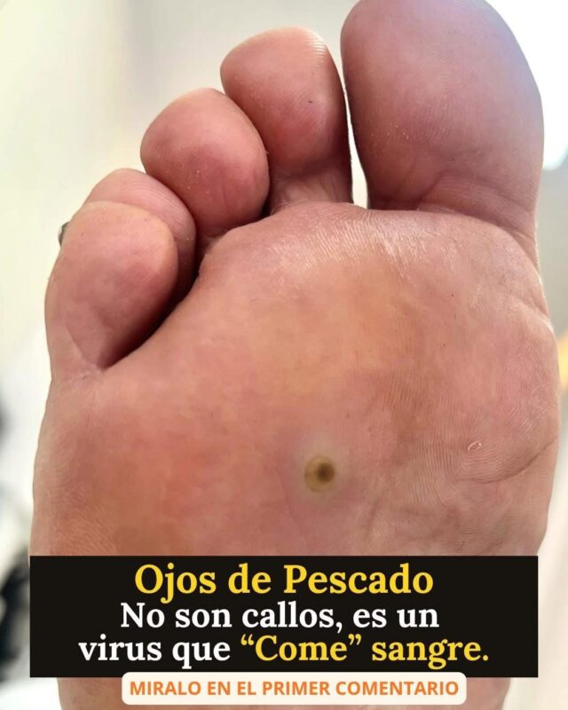 Ojo de pescado: pequeño en apariencia, grande en molestia